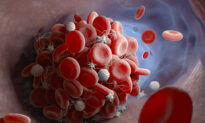 2 Types of Vaccinated or Long-COVID Patients Have a Higher Risk of Blood Clots